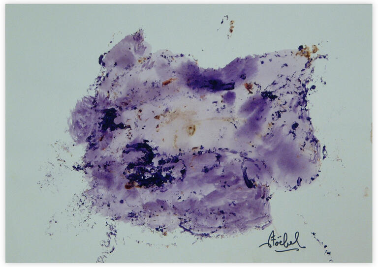 Catalogue raisonné, Edgar Stoëbel, abstract — 