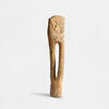 tibia et péroné. 2004